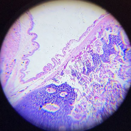 Microscopic image of fetal tissue